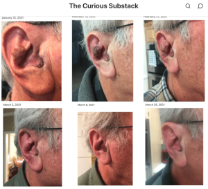 Skin-Tx-Curious-Substack